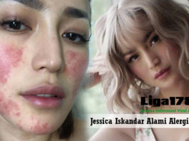 Jessica Iskandar, Anastesi, kulit wajah, Liga178 news