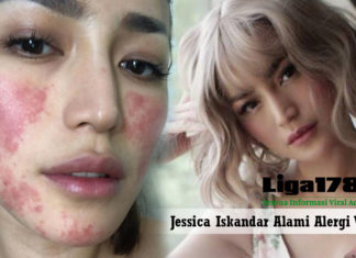 Jessica Iskandar Alami Alergi Pada Kulit Wajah Jessica Iskandar, Anastesi, kulit wajah, Liga178 news