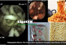 Kebanyakan Makan Mie Instan akan menderita Penyakit Usus Buntu, Ini Faktanya Mi Instan, Facebook, cacing Ascaris, WHO, Liga178 News