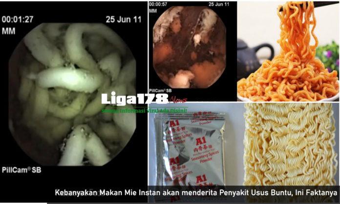 Mi Instan, Facebook, cacing Ascaris, WHO, Liga178 News