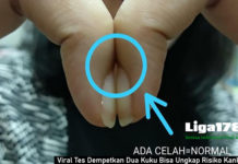 Viral Tes Dempetkan Dua Kuku Bisa Ungkap Risiko Kanker Paru
