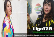 Via Vallen Operasi Plastik, Tampil Dengan Pipi Chubby Nya