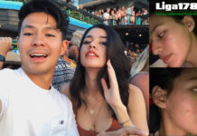 Wajah Hancur, Susan Sameh Menangis dan Malu Aktris berparas cantik, Susan Sameh mengalami pengalaman buruk mengenai produk kecantikan diri, yang hingga menyebabkan wajah nya berubah menjadi hancur.