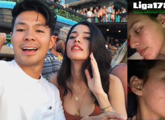 Wajah Hancur, Susan Sameh Menangis dan Malu Aktris berparas cantik, Susan Sameh mengalami pengalaman buruk mengenai produk kecantikan diri, yang hingga menyebabkan wajah nya berubah menjadi hancur.