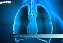 Penyakit TBC, Indonesia Ranking ke-3 Pengidap TB Terbanyak Hilangkan TBC, Hidup Indonesia, Kesehatan Indonesia