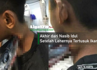 Akhir dari Nasib Idul Setelah Lehernya Tertusuk Ikan Sori ikan sori, Muhammad Idul, Operasi, Liga178 News